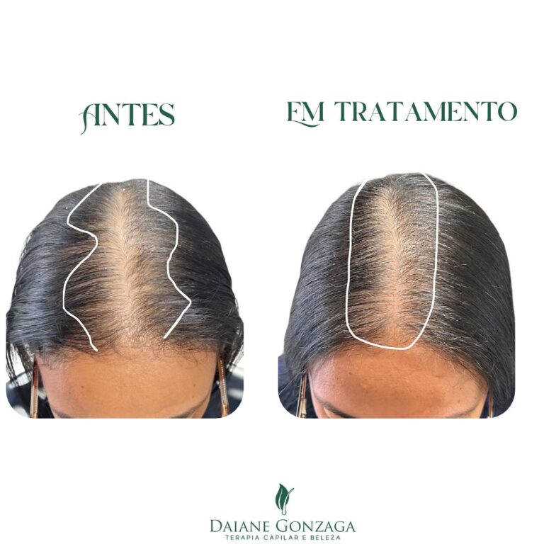 Instagram post from daianegonzagaterapiacapilar. This post is in position 10.